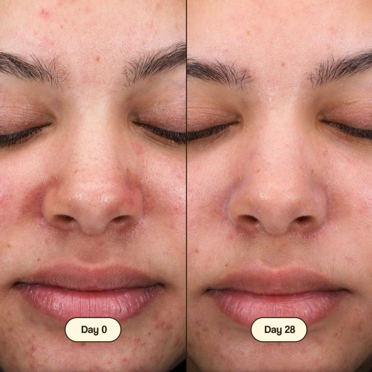 Fresly Salicylic Facial Cleanser 100 ml