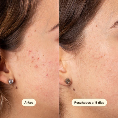 Krem do twarzy Azelaic Radiance Face Serum Freshly 50 ml