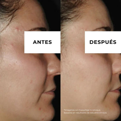 Equilibrium anti-acne cream for oily skin Arganour 30ml